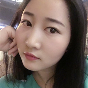 武漢美都張召醫(yī)生做的自體脂肪豐額頭+太陽穴，真實(shí)案例分享