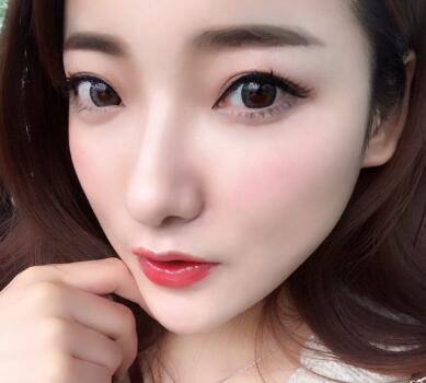 戴隱形牙套矯正牙齒前后對(duì)比圖——成都圣貝牙科醫(yī)院