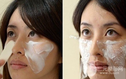 “人未老，皺先行”，注射除皺面部年輕化修復過程