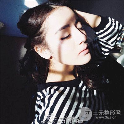 溫州友好醫(yī)院尹建祥隆鼻整形真人案例分享