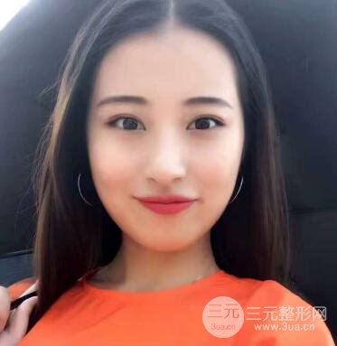 痘坑痘疤要怎么修復?果酸換膚后臉果圖和真實案例分享