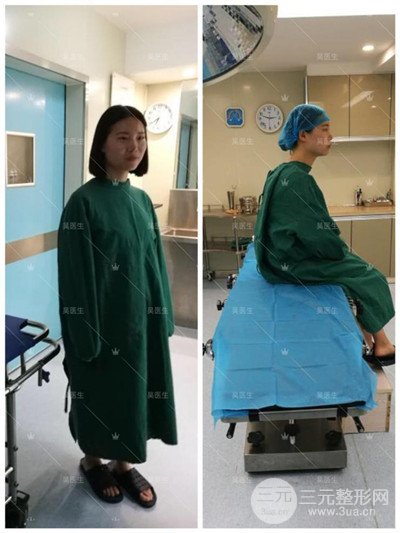 武漢卓美吳秀英雙眼皮+開(kāi)眼角一個(gè)月恢復(fù)對(duì)比照片分享~