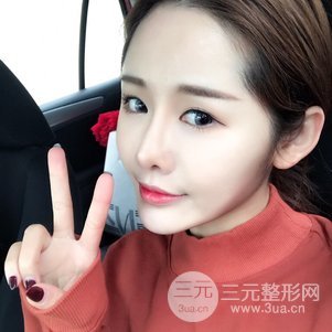 南京美萊陳天杰自體脂肪填充全臉 女神的養(yǎng)成記！