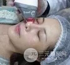 我做了光子嫩膚幾天起而且價(jià)格便宜前后對比照片案例