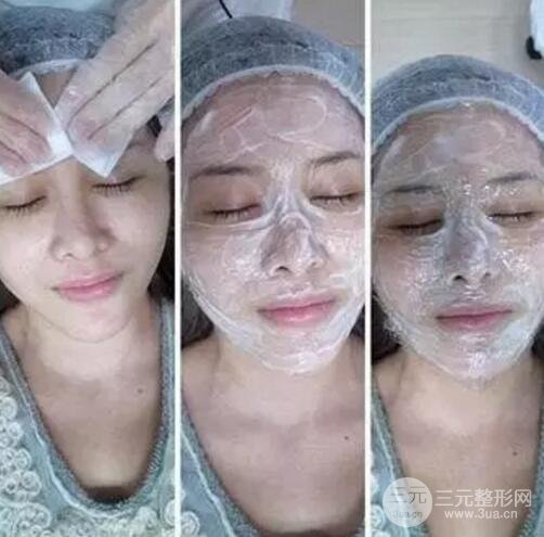 我做了光子嫩膚幾天起而且價(jià)格便宜前后對比照片案例