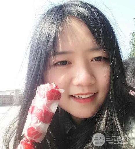 怎樣減掉雙下巴?雙下巴吸脂后個人經(jīng)歷 價格略貴但果好