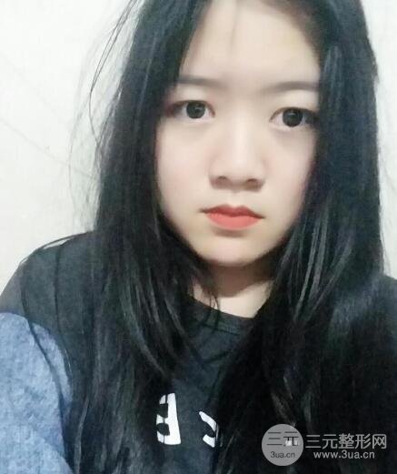 怎樣減掉雙下巴?雙下巴吸脂后個人經(jīng)歷 價格略貴但果好