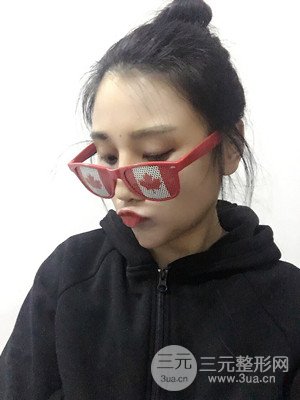 珠海萊茵門診部馬中衛(wèi)隆鼻整形案例分享，并附上前后對(duì)比照片~