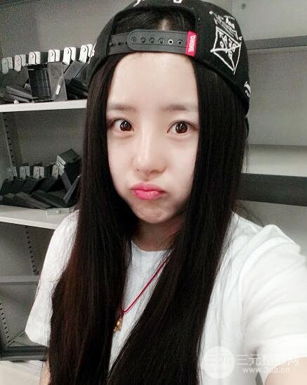 隆鼻整形包括假體隆鼻+耳軟骨墊鼻尖+鼻小柱延長(zhǎng)