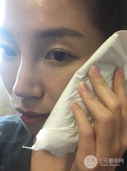 面b提升術(shù)多少錢?價(jià)格和案例分享