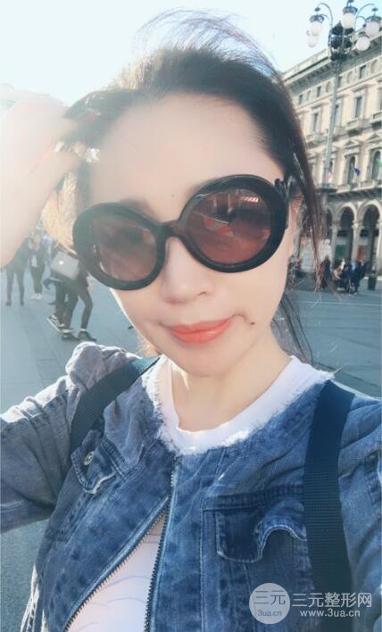 面b提升術(shù)多少錢?價(jià)格和案例分享