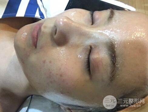 注射水光補水價格和案例圖片