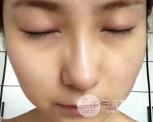 注射水光補(bǔ)水價(jià)格和案例圖片