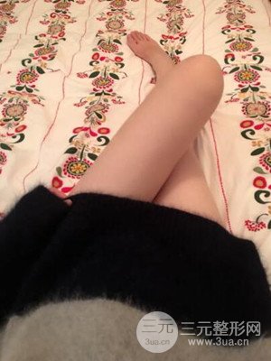 珠海萊茵門(mén)診部盧剛給我做的大腿抽脂手術(shù)，前后對(duì)比圖分享