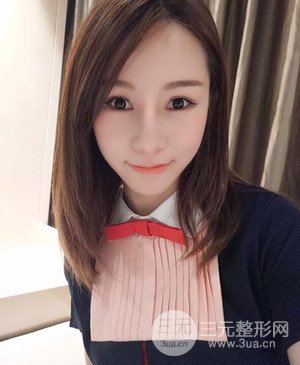 武漢美都張召醫(yī)生給我做的隆鼻整形手術(shù)，給大家分享一下前后照片