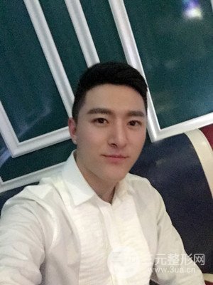 玻尿酸豐額頭手術前后過程以及真實案例分享——武漢美都朱紅霞醫(yī)生做的