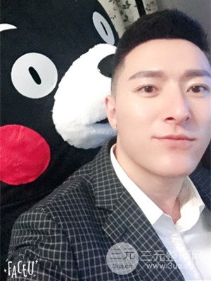 玻尿酸豐額頭手術前后過程以及真實案例分享——武漢美都朱紅霞醫(yī)生做的