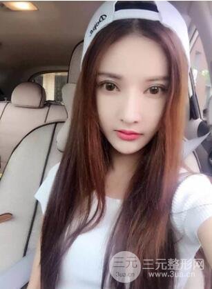 我的埋埋蛋白線.提升日記：真實(shí)案例——濰坊華美童艷梅醫(yī)生做的