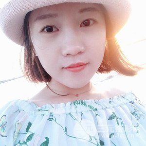 注射水光補(bǔ)水案例——襄陽(yáng)維多利亞聶立敏醫(yī)生做的