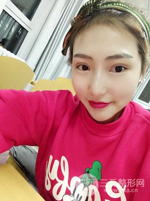 激光脫毛前后照片分享，真實(shí)案例~