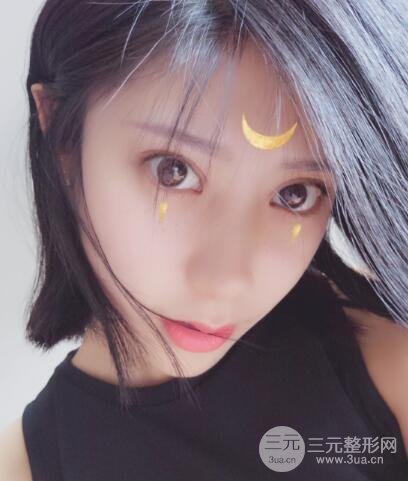 成都嬌點(diǎn)李競(jìng)割雙眼皮價(jià)格和案例