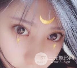 成都嬌點李競割雙眼皮價格和案例