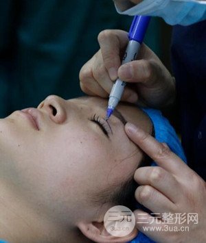 武漢葉子葉飛醫(yī)生給我做的切開雙眼皮手術(shù)，分享一下前后對(duì)比圖