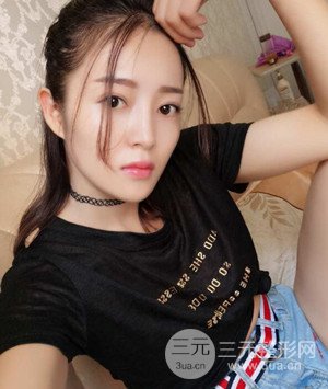 武漢葉子葉飛醫(yī)生給我做的切開雙眼皮手術(shù)，分享一下前后對(duì)比圖