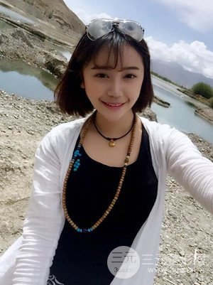 假體隆鼻+耳軟骨墊鼻尖真實(shí)案例，并附上前后對(duì)比圖~