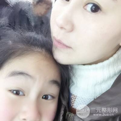 武漢美侖陳遠(yuǎn)海自體脂肪填充全臉案例，附上前后對比圖片