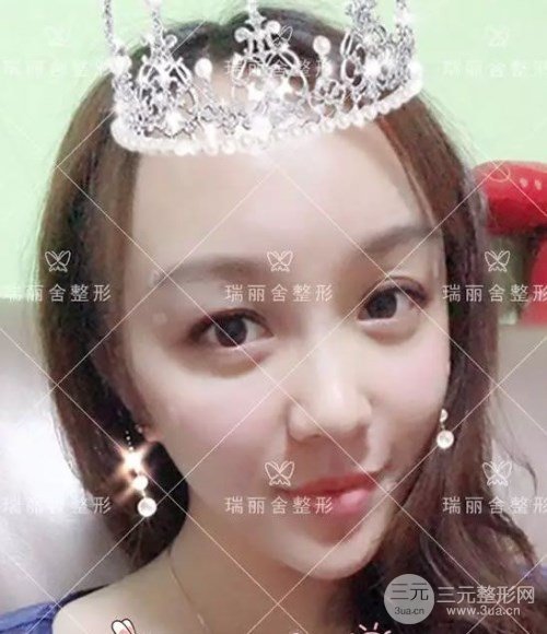 術(shù)后第(一)天恢復(fù)情況