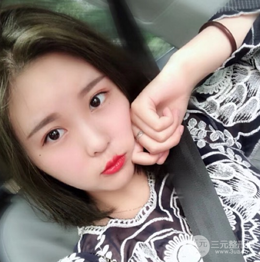 面部光纖溶脂三個月恢復記錄，妹子終于擺脫大臉盤子辣