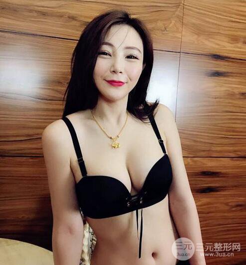 自體脂肪豐胸3個月分享，活細胞豐胸術(shù)后果逼真更自然