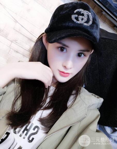 【隆鼻失敗修復(fù)】自體脂肪隆鼻隆鼻整形拯救之后可以隨意揉捏！