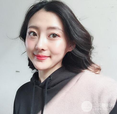 【肋軟骨隆鼻+歪鼻矯正案例】降低風(fēng)險(xiǎn)無排異，可隨意揉捏