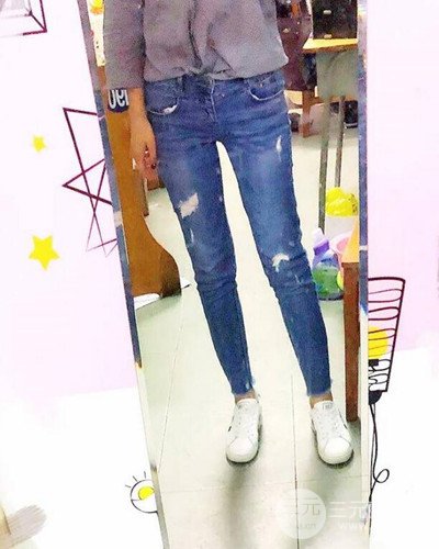 廣州韓妃大腿吸脂案例，恢復(fù)過程前后對(duì)比圖片分享~