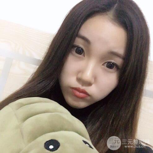 下頜角磨骨整形全過(guò)程分享，附上術(shù)后恢復(fù)照片~