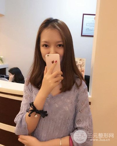 深圳蒳美邇黃海彬雙眼皮案例恢復(fù)過程對比圖分享~