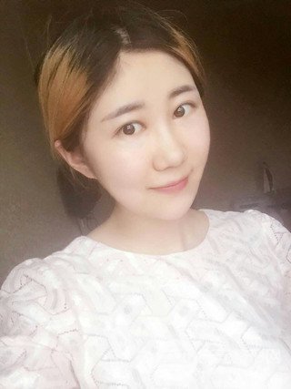 深圳臻希美詳細(xì)部自體脂肪填充果對(duì)比超明X