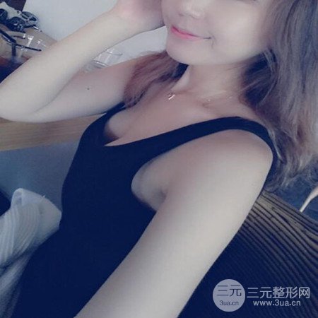 廣東省第二人民醫(yī)院羅盛康假體隆胸前后對(duì)比案例