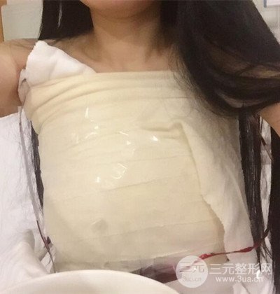 假體隆胸手術(shù)恢復(fù)記錄，豐滿大胸不是夢(mèng)