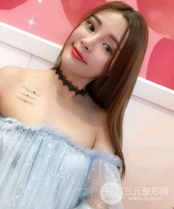 模特做隆鼻整形真實日記分享，附上恢復過程圖