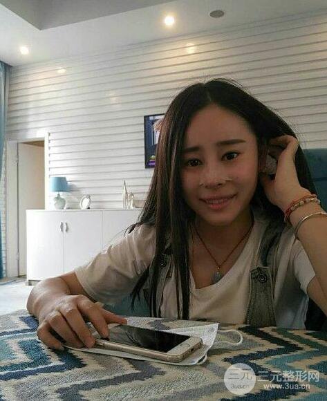 成都華顏賈德淵隆鼻失敗修復真實案例分享，并且附上前后對比照片