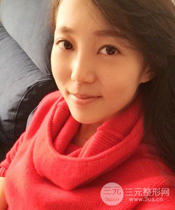 深圳內(nèi)切去眼袋+硅膠墊下巴真實案例恢復(fù)果圖