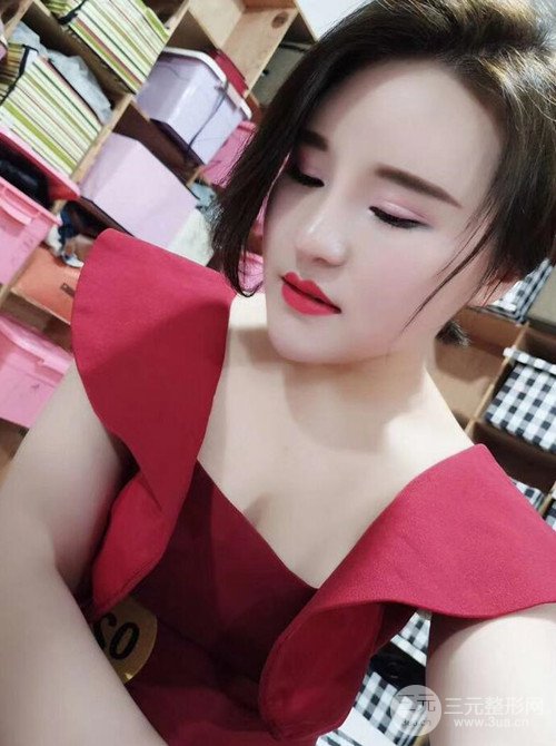 上海麗質(zhì)呂成醫(yī)生做的吸脂瘦臉日記，前后恢復(fù)圖分享