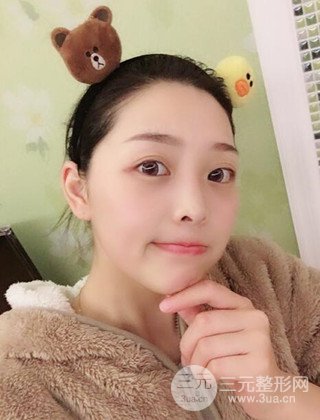 面部吸脂瘦臉手術(shù)日記分享，瘦臉果驚人