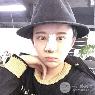 北京協(xié)和劉志飛隆鼻修復(fù)案例恢復(fù)過程日記分享