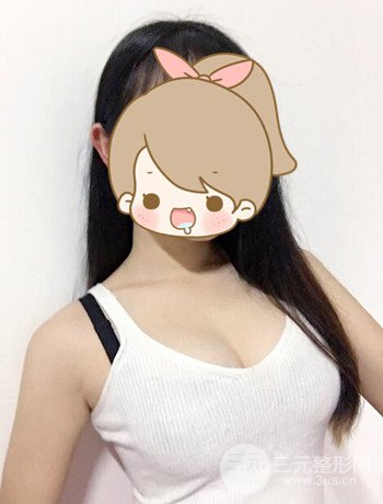 北京自體脂肪隆胸手術(shù)日記分享，豐胸術(shù)后恢復(fù)果圖