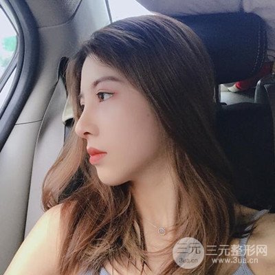 廣州藝美隆鼻日記分享！前后對比圖奉上！