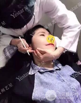 溫州藝星打B****案例術后恢復日記